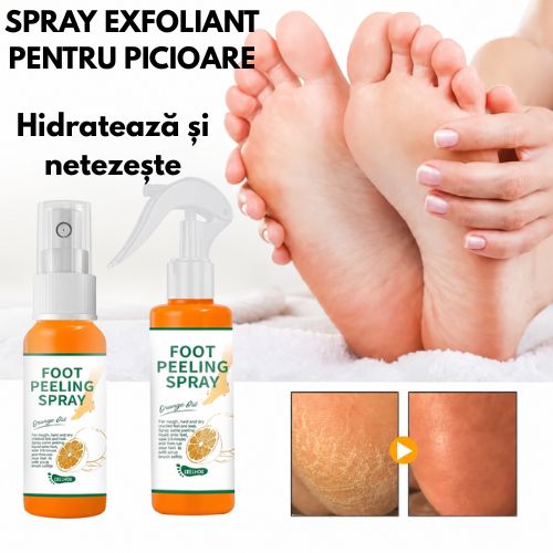 FootSoft™ - Spray Exfoliant pentru Picioare 100ML